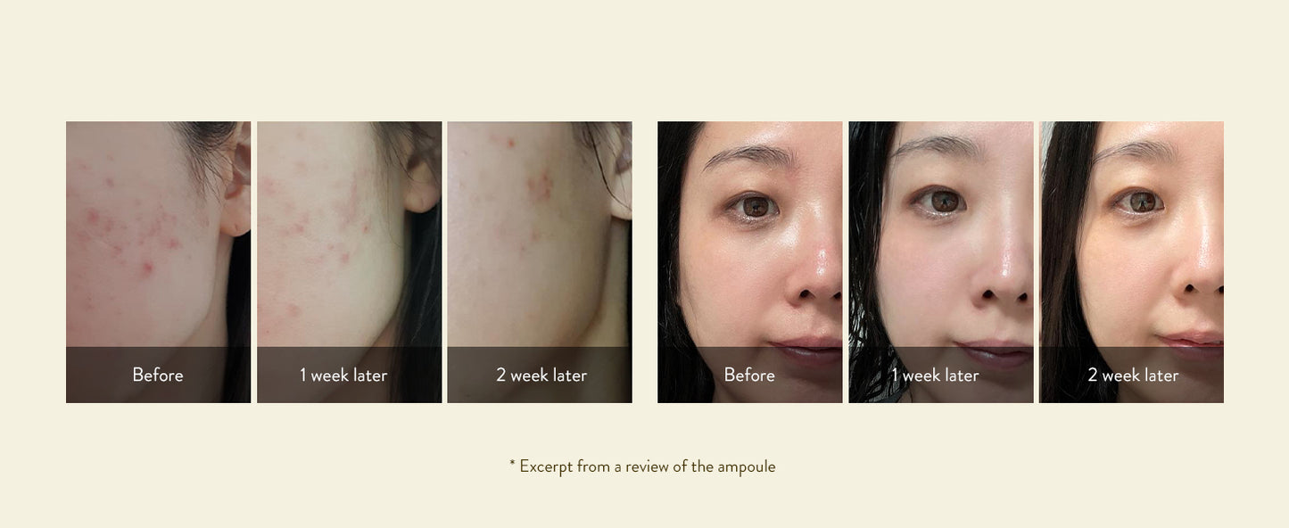 SIORIS Drops of Omija Calming Ampoule